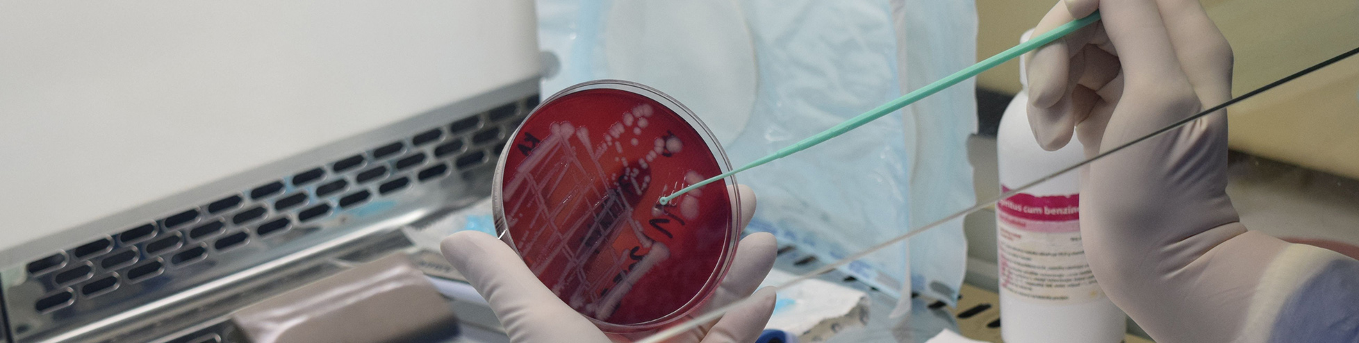 Laboratórium klinickej  mikrobiológie